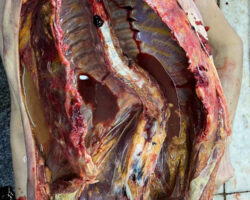 Autopsy photos showing scoliosis