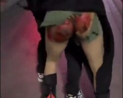 Biker scrapes his butt on asphalt