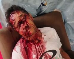 Criminal found stabbed with smashed head