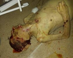 Deranged patient brutally murdered another patient in hospital