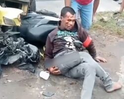 Dude got broken leg in collision with truck
