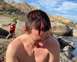 Dude injured his head when he dived into rock