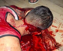 Five people injured during bloody fight in Ecuador