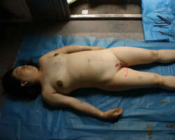 Forensic autopsy with educational annotations