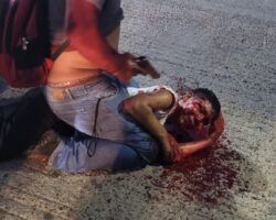 Guy defended himself from robber and painfully detained him
