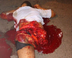 Guy lost his leg and died during illegal motorcycle race