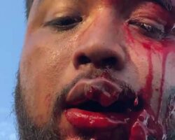 Guy started broadcasting live after being shot in face