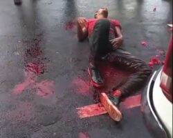 Injured robber after shootout with police