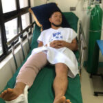 Man attacked by crocodile after mistaking it for statue
