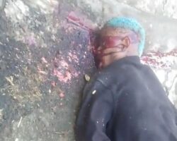 Shot in head in argument over his girlfriend