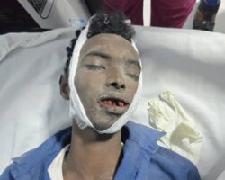Two Somalis suffered serious injuries in traffic accident