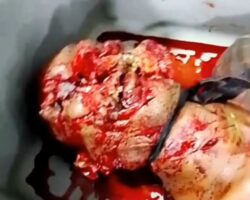 Victim of brutal machete attack