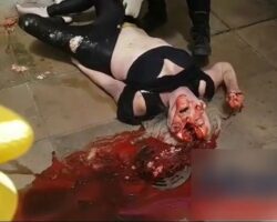 Woman has completely cracked skull