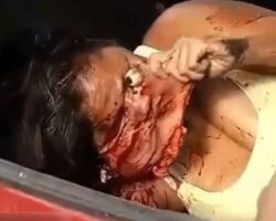 Woman has nearly her entire face torn off after car crash