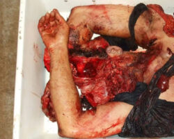 Worker fell into sugar cane crushing machine