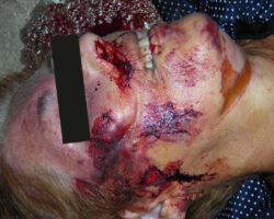 68-year-old woman strangled by almond peeling machine