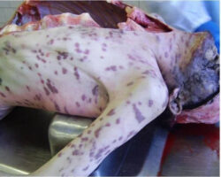 Autopsy of HIV-positive and drug-addicted man
