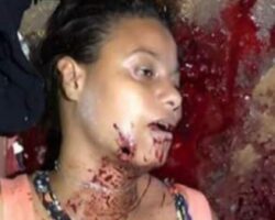 Brazilian woman shot in face