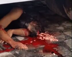 Bus pushed drunk man’s brain out of his head