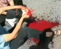 Chinese man lost his foot during motorcycle accident
