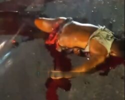 Collision between biker and car tore off his entire leg