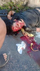 Collision between motorcycles, fire, and death of two people