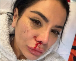 Curvy influencer Soraya Riffy mutilated after rape