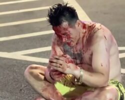 Dude gets his face slashed with broken bottle during drunk fight