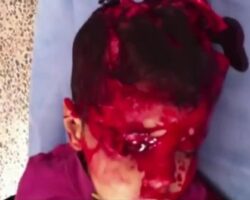Fatally injured Syrian children