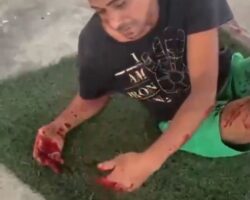 Favela thief gets all his fingers broken with sledgehammer