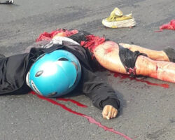 Fetus ejected from mother during motorcycle accident