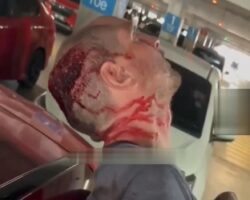 Foreigner attacked and injured in parking lot in Kuala Lumpur