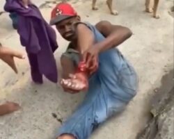 He’s trying to reattach his amputated foot
