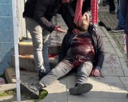 Mass fight in Turkey ended with one death and three injured