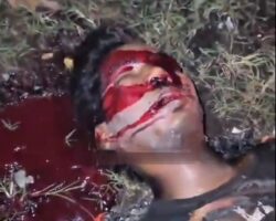 Motorcycle burns after crash, driver dead, passenger badly injured