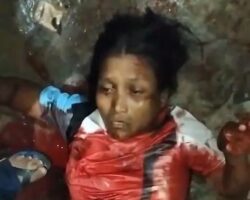 Peruvian woman brutally stabbed by husband