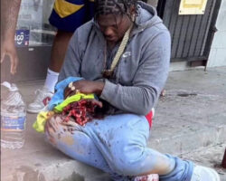 Rapper 4Xtra blew up his hand with fireworks