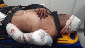 Robber seriously injured in gas station robbery attempt