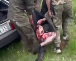 Russian soldier after stepping on landmine