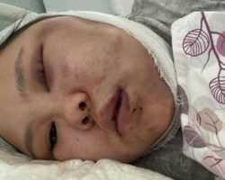 Russian woman beaten by her drunken husband