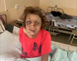 Russian woman nearly tortured her mother to death