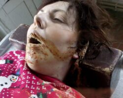 Russian woman took fatal dose of suicide-prevention meds