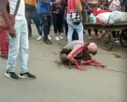 Seriously injured thief by machete
