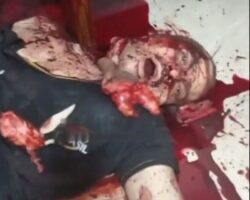 Severed penis for having sex with another man’s wife