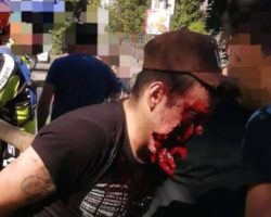 Thief shot in jaw with shotgun