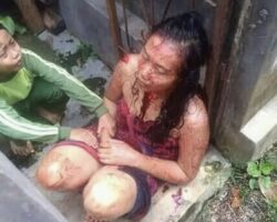 Woman survives machete attack by her husband