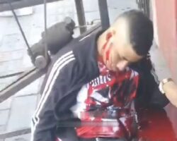 Young man gunned down right in the middle of street