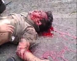 Aftermath of serious bus accident in Costa Rica