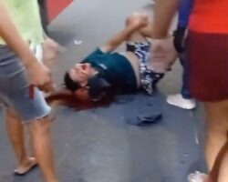 Biker is in shock after realizing that the accident cost him whole arm