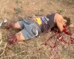 Car accident tore off all his limbs